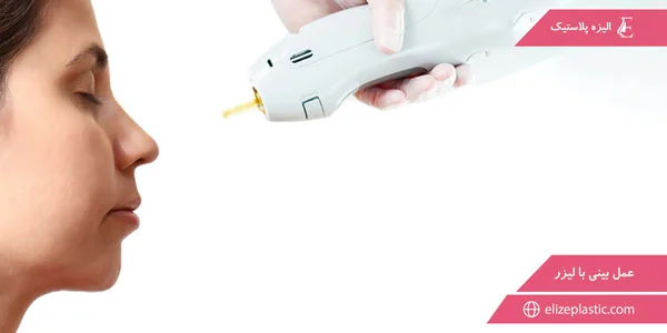 Laser-nose-surgery