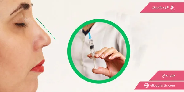 elizeplastic.com-Nose-filler