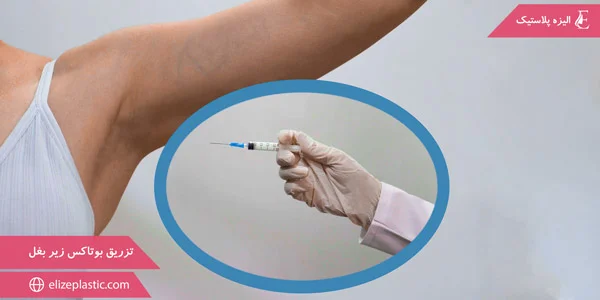 Underarm-botox-injection